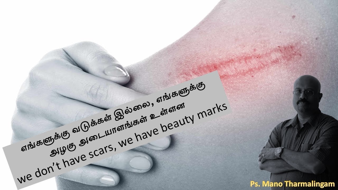 எங்களுக்கு வடுக்கள் இல்லை, எங்களுக்கு அழகு அடையாளங்கள் உள்ளன